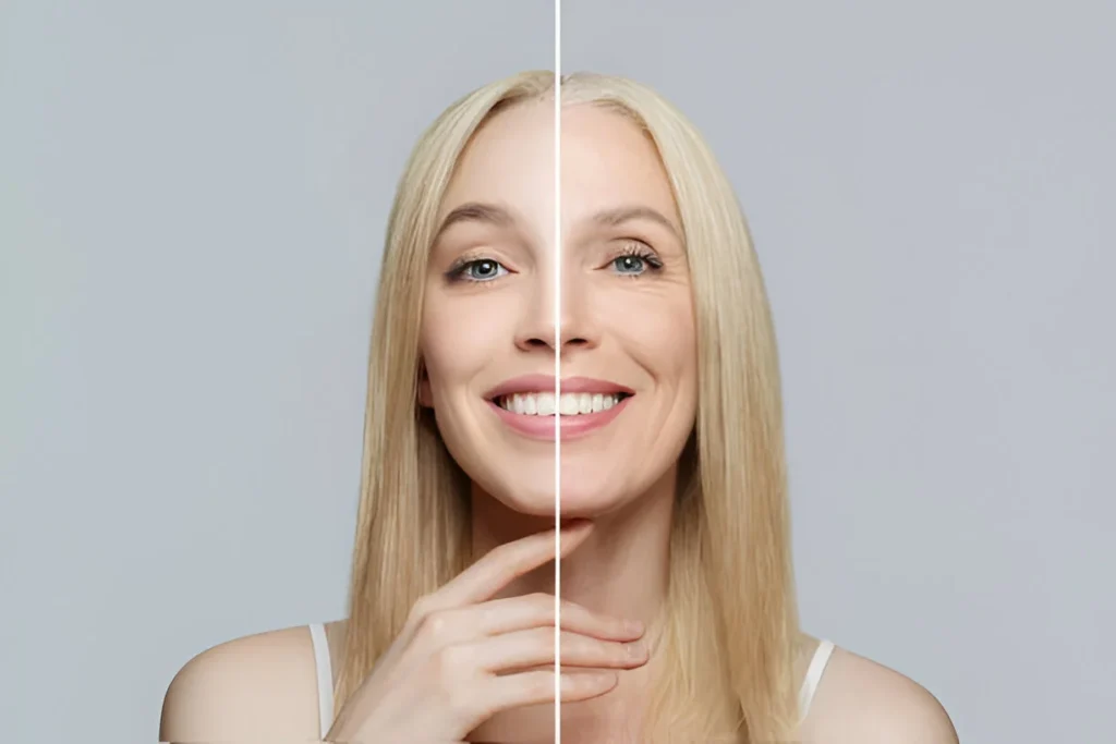 Hair Transplant - Featured Image